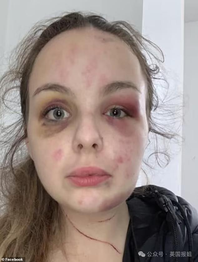 19岁女孩遭多次暴力侵犯,反被判刑8年半?真相反转震撼英国:她故意用铁锤砸自己编故事!