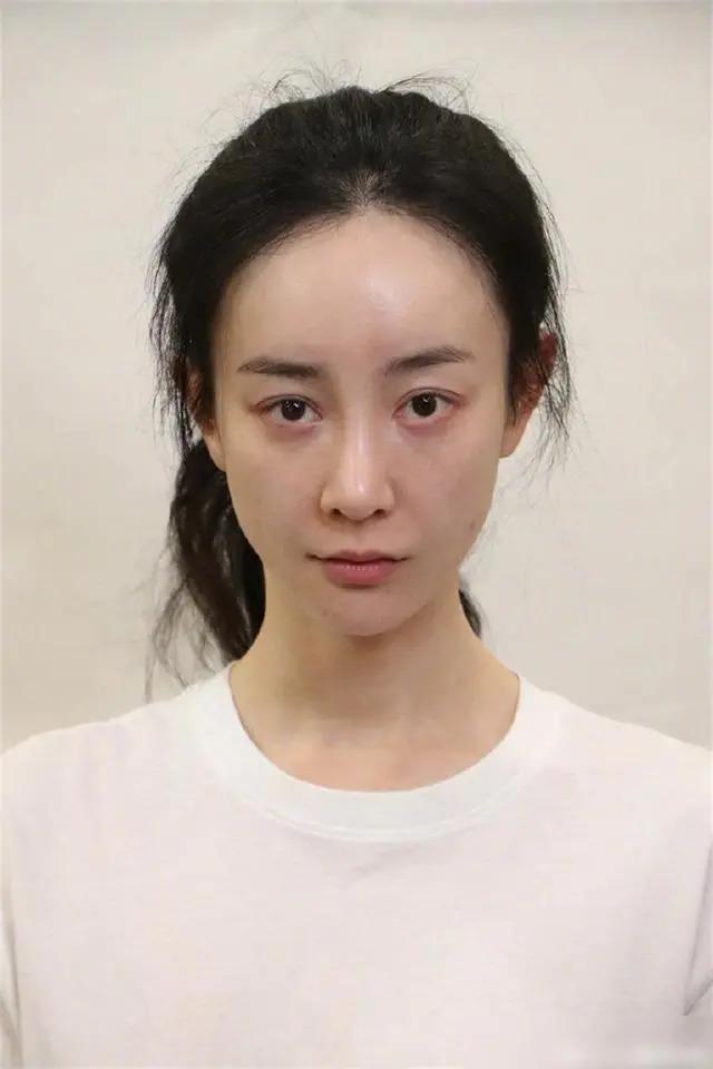 挑衅原配缺爱整容，无戏可拍备孕失败，张檬被暗讽是报应