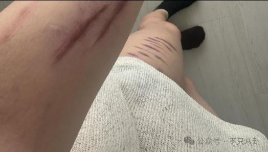 本来挺同情她的，现在都吐槽她是癫婆？！