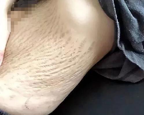 《快乐星球》“冰柠檬”张兆艺，已经生二胎了！