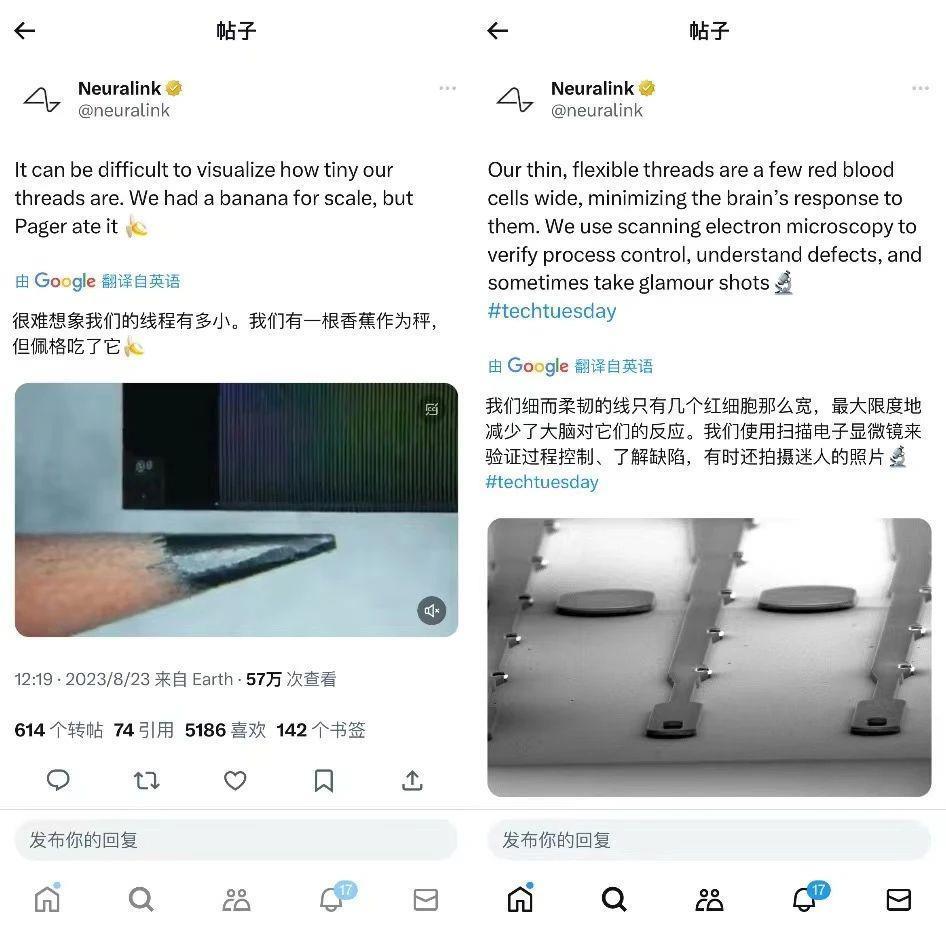 今天，马斯克往人脑里塞了块思维读取芯片。