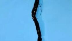 近40厘米!医生惊了:这么长的血栓…怎么来的?迷惑性极强,曾有人被误诊