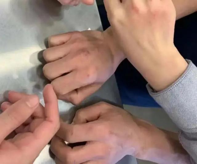 “在瑞幸烂掉的手，亲妈看了都摇头”