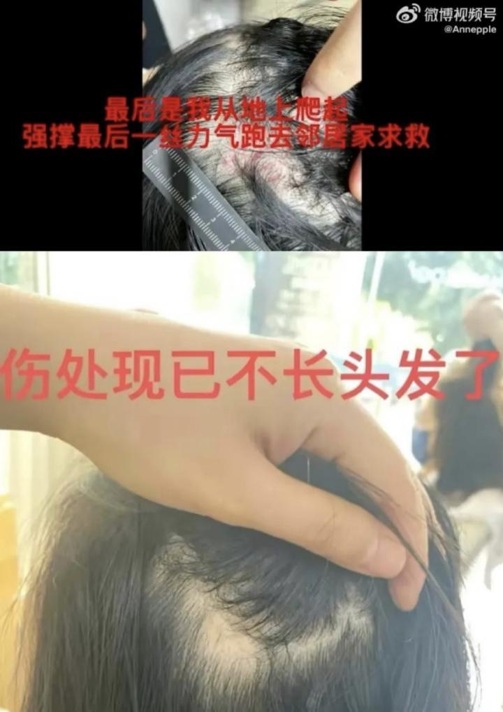 还记得《都挺好》里的王东吗？家暴妻子并让其上街乞讨？