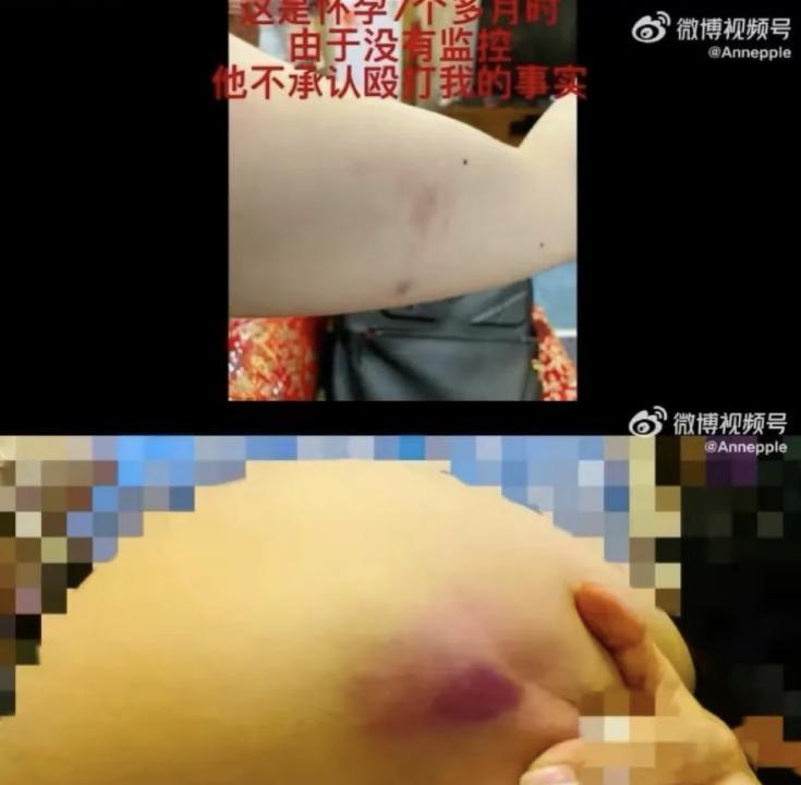 还记得《都挺好》里的王东吗？家暴妻子并让其上街乞讨？