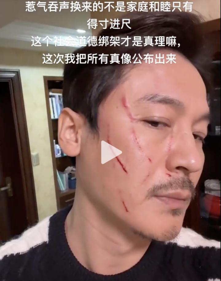 还记得《都挺好》里的王东吗？家暴妻子并让其上街乞讨？