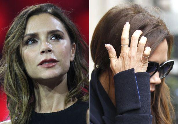 贝嫂突发意外受重伤,如今得靠拐杖行走.