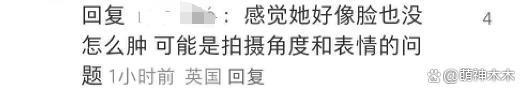 凯特王妃术后首露面！面相变样惹争议，威廉王子反应心虚