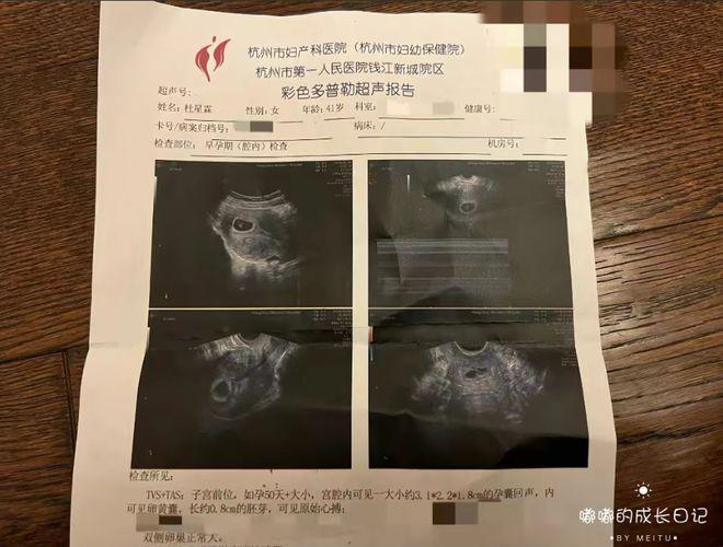 72岁张纪中再当爹，妻子杜星霖晒彩超官宣怀四胎