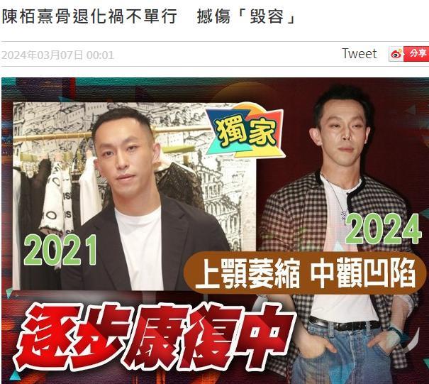 香港富二代毁容，与关之琳暧昧的他面目全非，让人不敢认