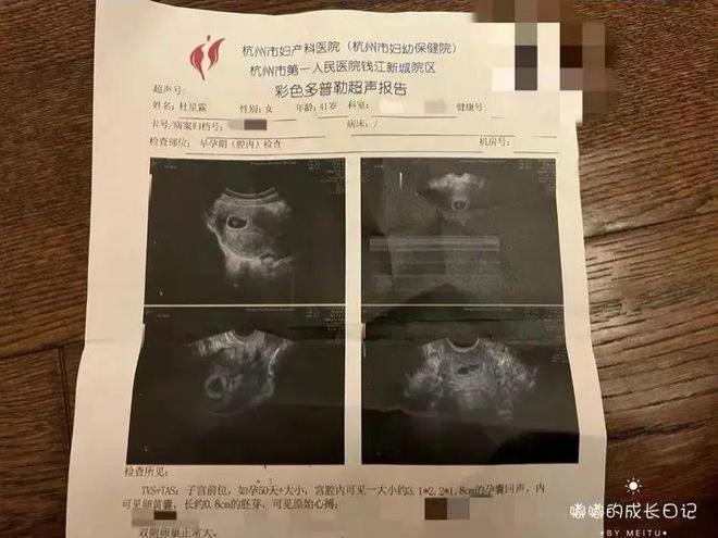 73岁张纪中喜当爹，42岁妻子晒图难掩幸福，不想低调