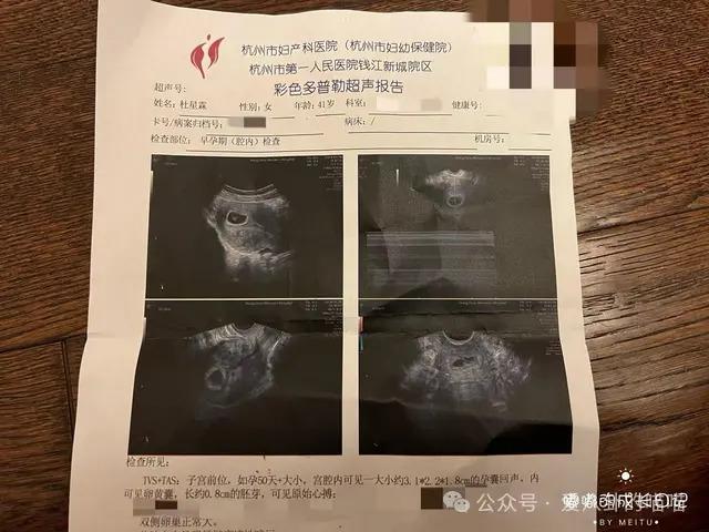 72岁张纪中宝刀未老，小30岁娇妻又怀孕了，喜提龙宝宝